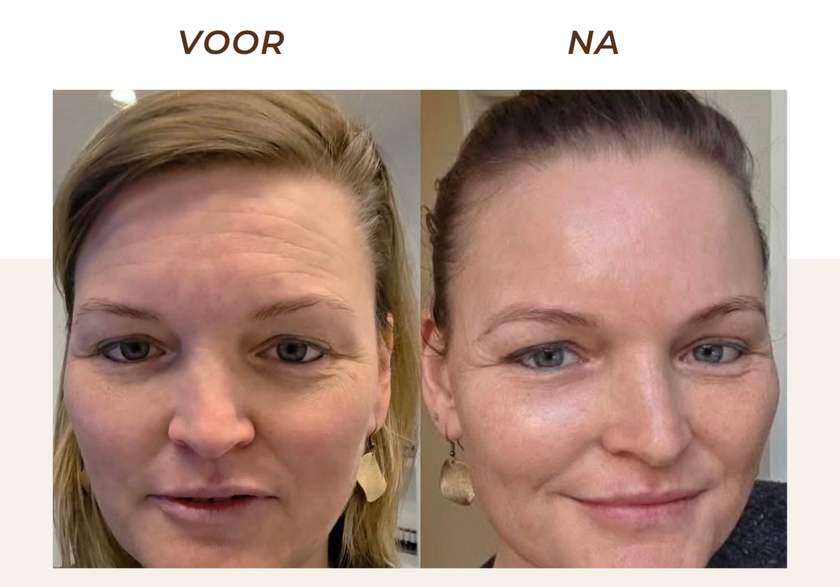 LIFTOLOGY LIFT face mask | Box met 4 maskers | Collageen anti-aging masker voor huidverstrakking